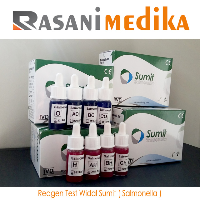 Reagen Test Widal Sumit ( Salmonella )