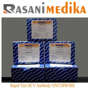 Rapid Test HCV Antibody ONCOPROBE